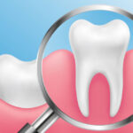 gums-healthy